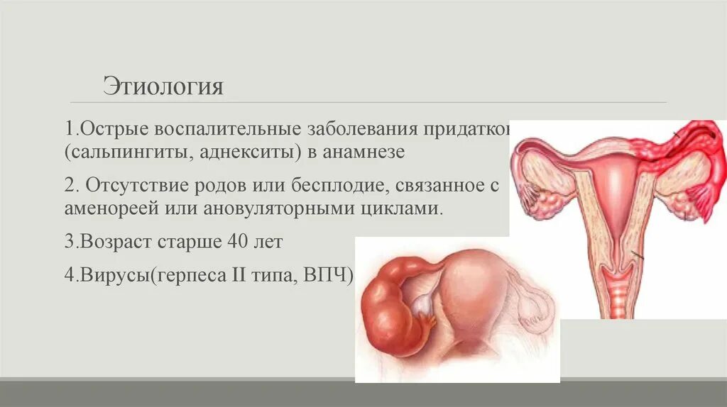 Гонорейный сальпингит. Сальпингоофорит яичника. Острый сальпингоофорит этиология. Гонорейный сальпингоофорит. Аднексид