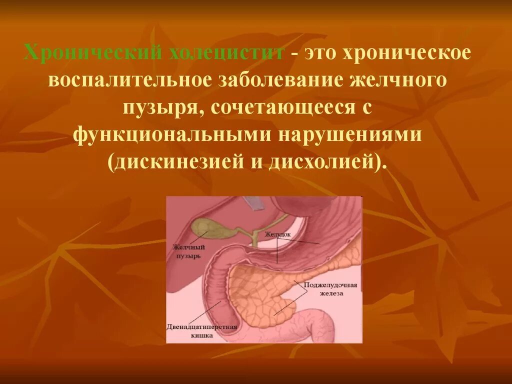 Хронические заболевания холецистит