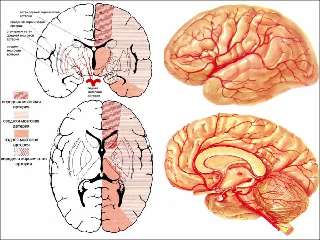 Зона ишемии. Ишемический инсульт левая средняя мозговая артерия. Ишемический инсульт зоны поражения головного мозга. ОНМК В бассейне левой средней мозговой артерии. ОНМК В левой средней мозговой артерии.