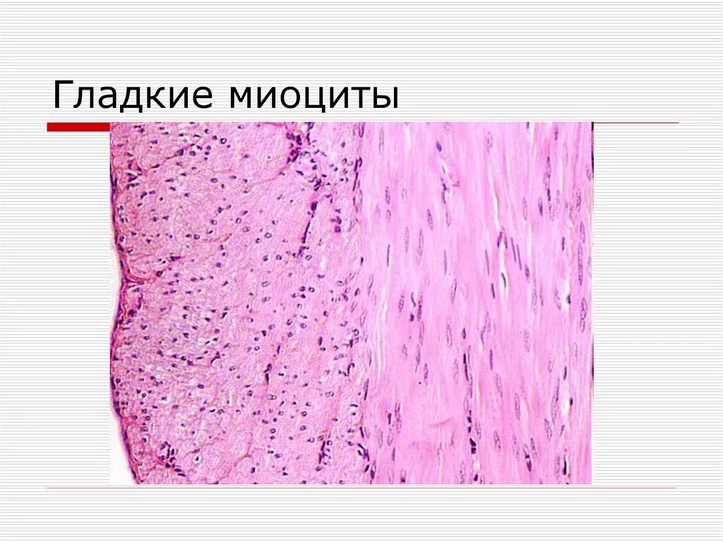 Строение клетки гладкая мышечная ткань. Миоциты гладкой мышечной ткани. Гладкая мышечная ткань гистология. Гладкие миоциты гистология строение. Гладкий миоцит гистология Электронограмма.