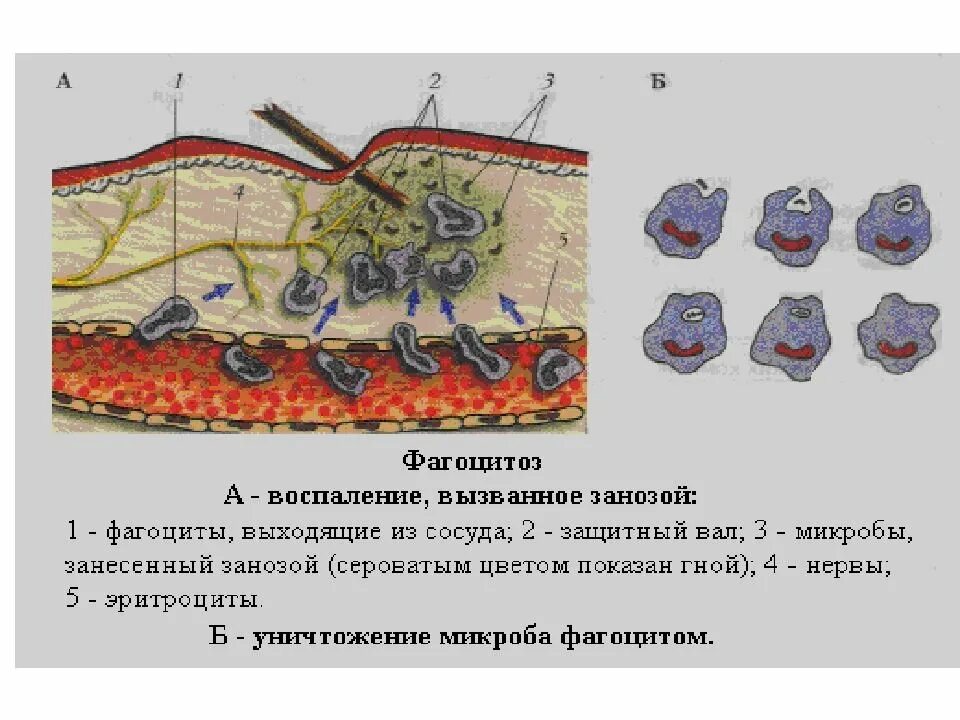 Воспаление фагоцитоз лейкоцит безразличный раздражитель микроворсинка. Фагоцитоз воспаление вызванное занозой. Рис 40 фагоцитоз. Фагоцитоз строение. Фогоситоз при восполнения.