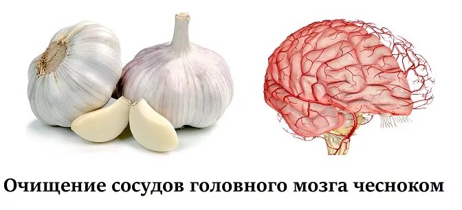 Очистка сосудов головы. Чеснок для очищения сосудов головного мозга. Очищение сосудов головного мозга народные средства. Овощи для очистки сосудов головы. Чеснок от сосудов.