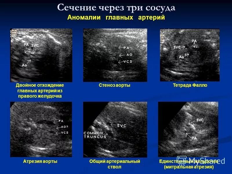 срез через 3