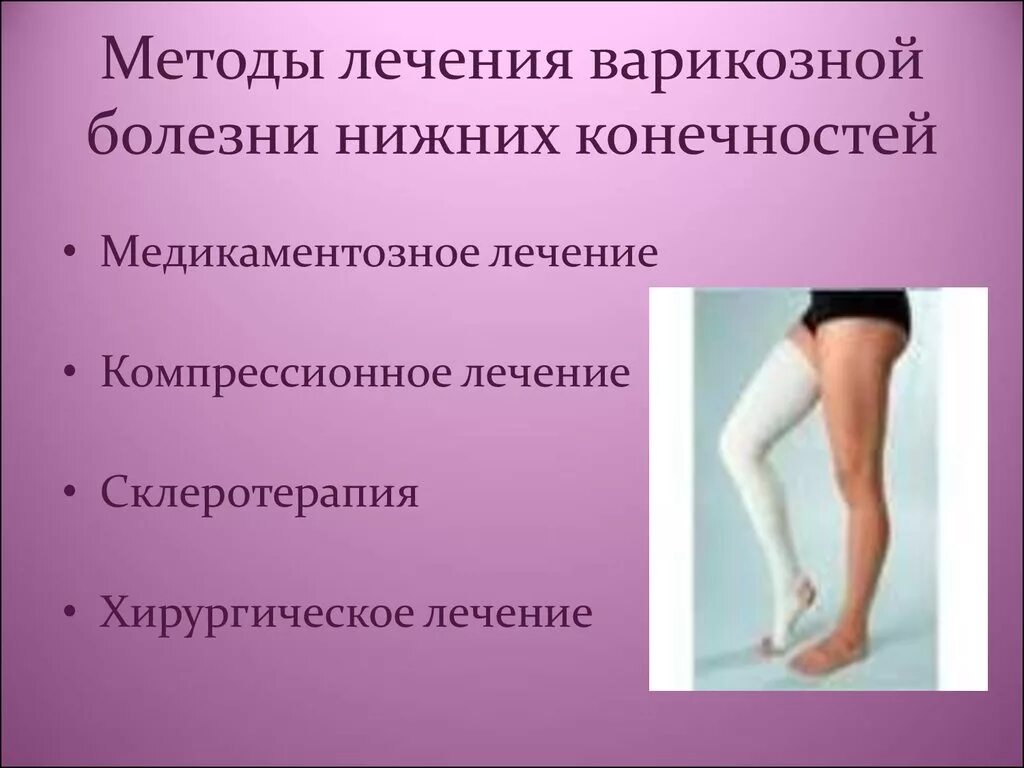 Лечение расширения вен нижних конечностей