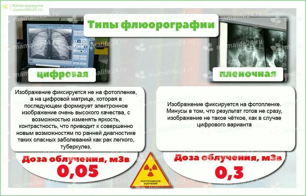 После рентгена можно делать флюорографию. Цифровая флюорография. Можно беременным флюорограф делать флюорографию. Пленочная и цифровая флюорография. Флюорография памятка.