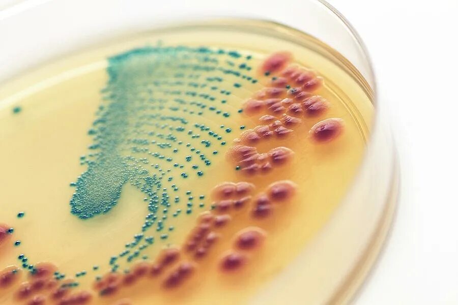 Кишечная палочка энтерококк. Энтерококк и эшерихия. Энтерококки на чашке Петри. Чашка Петри дисбактериоз. Кишечная палочка в Петри.