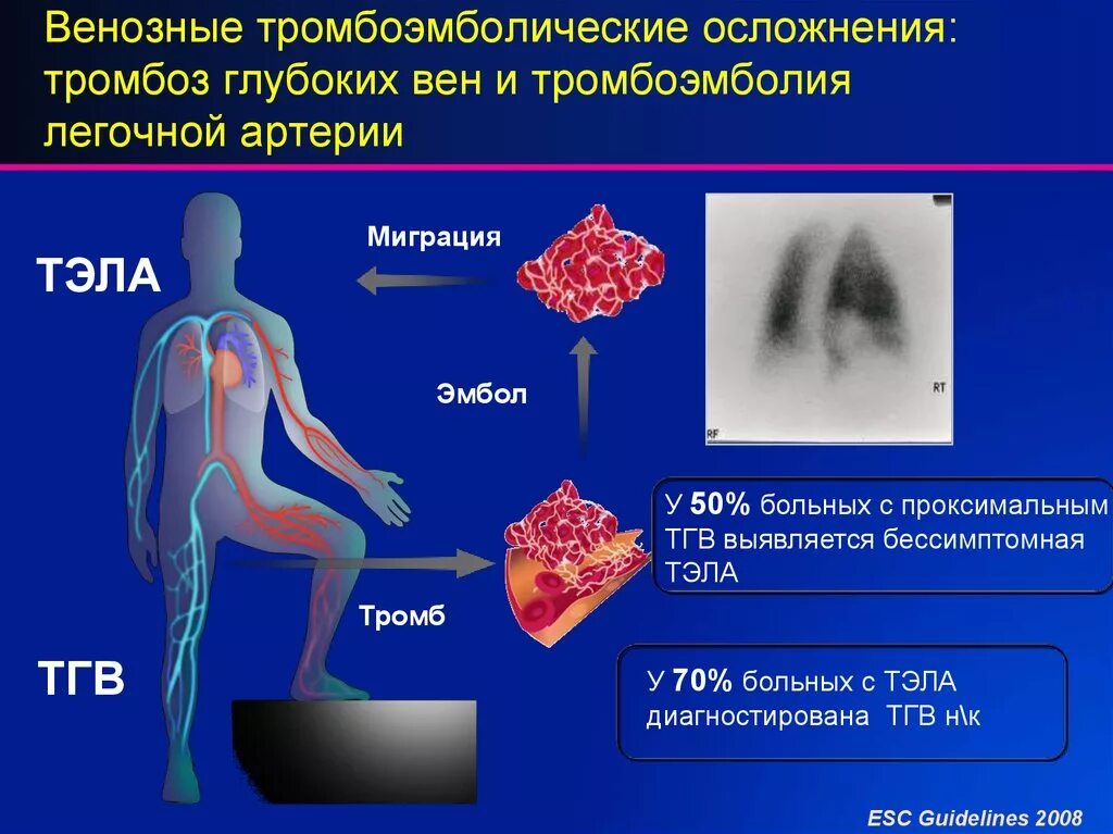 Тэла этиология и причины. Заболевания вен нижних конечностей Тэла. Венозные тромбозы и тромбоэмболия лёгочной артерии клиника. Постинъекционные осложнения венозные тромбозы. Тромбоз причины возникновения