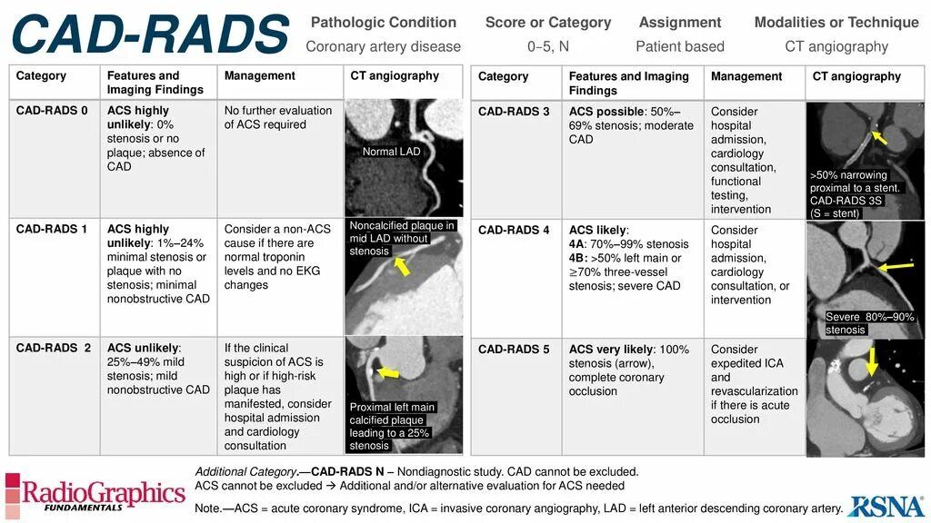 Ti-rads 1. Vi-rads 1. CAD rads. CAD rads классификация. Шкала rads