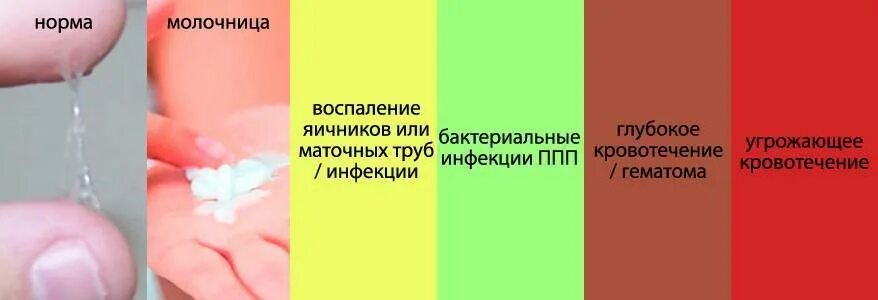 Выделения по цвету. Нормальный цвет выделений. женские выделения норма. нормальные выделения при беременности. выделения какого цвета норма.