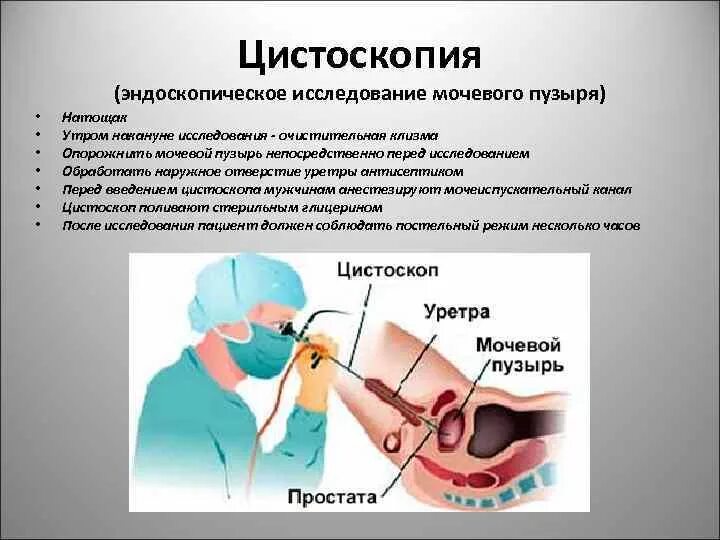 Ретроградная цистоскопия. Цистоскопия методика проведения.