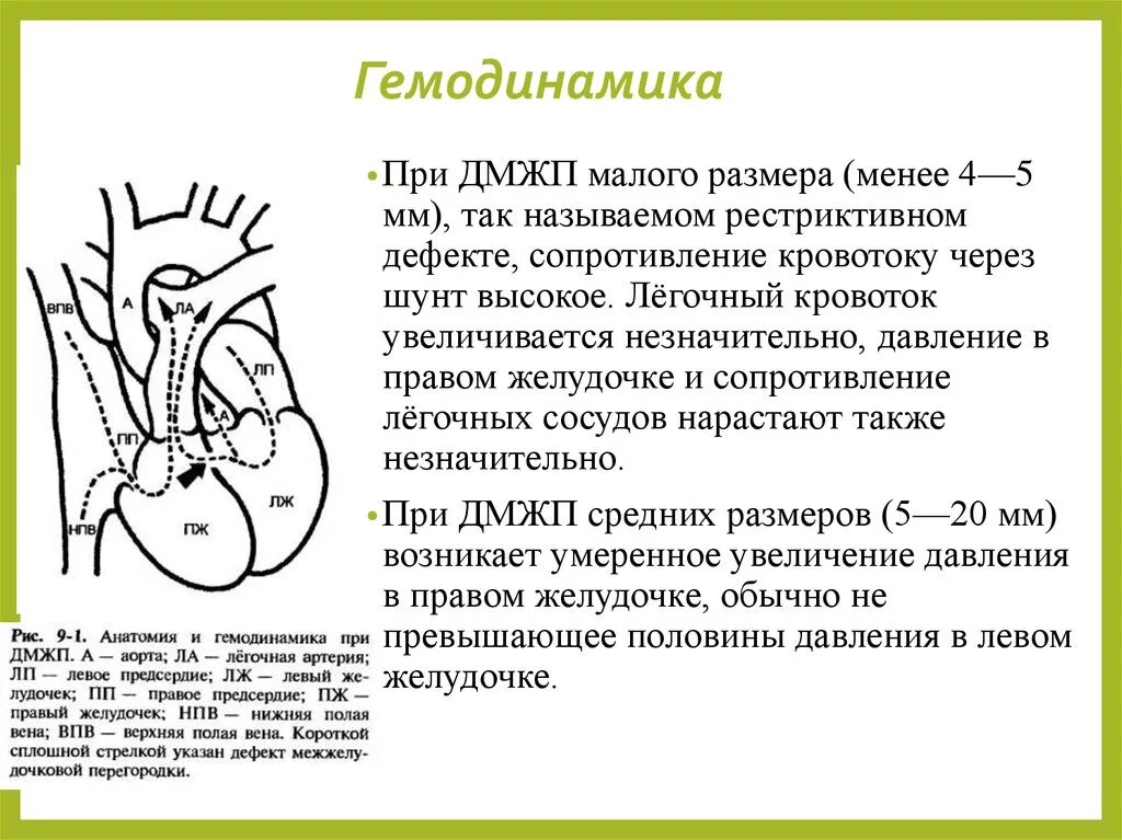 ДМЖП гемодинамика схема. Дефект межжелудочковой перегородки нарушение гемодинамики. Гемодинамика порока межжелудочковой перегородки. Гемодинамика при ДМЖП У детей. Гемодинамика пациента