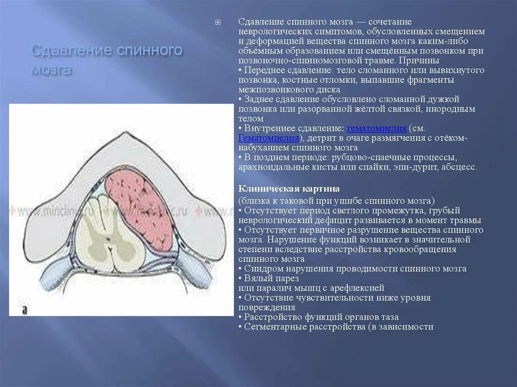 Компрессия спинного мозга симптомы. Сдавление спинного мозга клиника. Синдром сдавления спинного мозга. Уровни повреждения спинного мозга неврология.