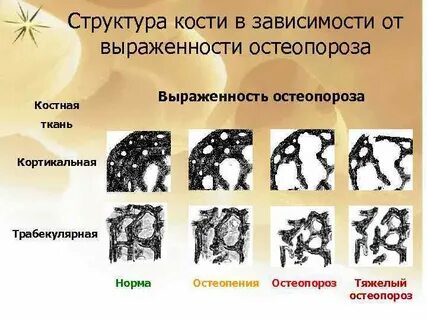 Костно структурных