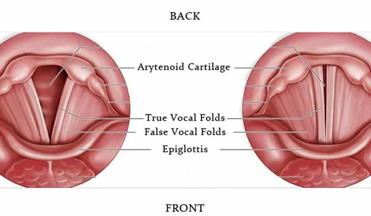 Голосовые связки у человека. Полип голосовой складки. Голосовая связка гортани.