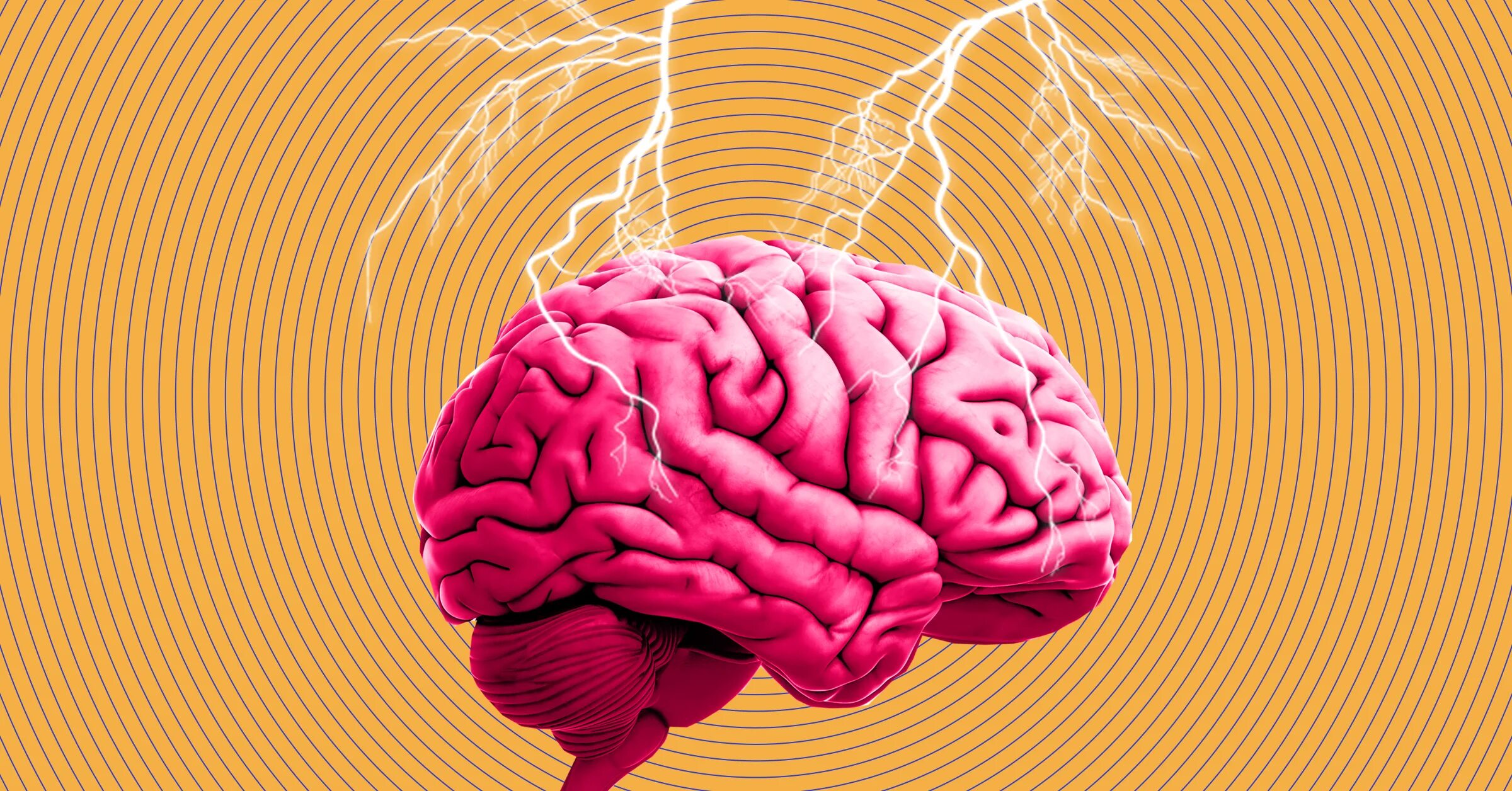 Мозг и агрессия. Электрошоковое воздействие на мозг. Мозг и принятие решений.