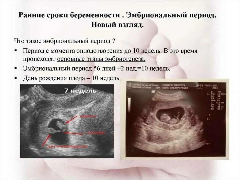 Как быстро замирает беременность. Срок беременности акушерский и эмбриональный. УЗИ беременности на ранних сроках. Эмбрион на УЗИ на раннем сроке.