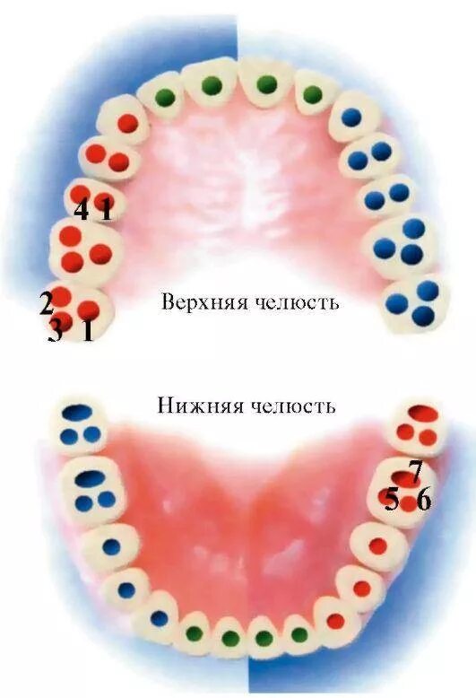 Схема устьев корневых каналов. Схема устьев корневых каналов зубов. Схема расположения корневых каналов в зубах. Расположение корневых каналов в 46 зубе.