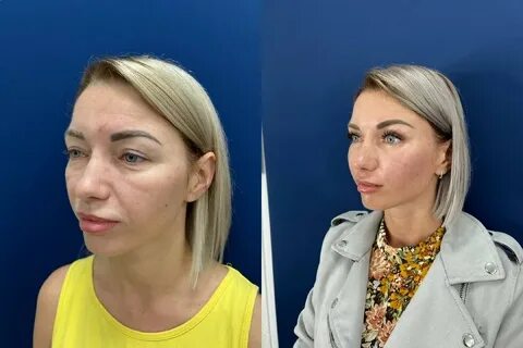 Глазунов хирург