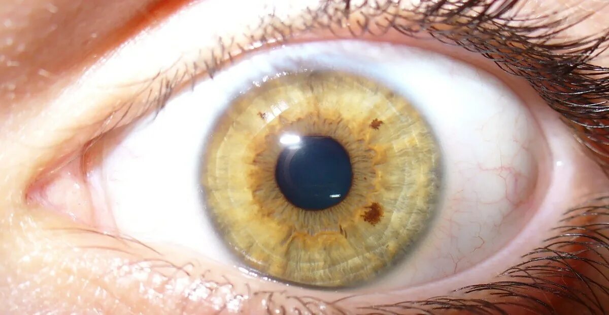 Цвет глаз человека определяется пигментацией. Желто коричневые глаза. Янтарная радужка глаза. Желтые глаза. Желтая радужка глаза.