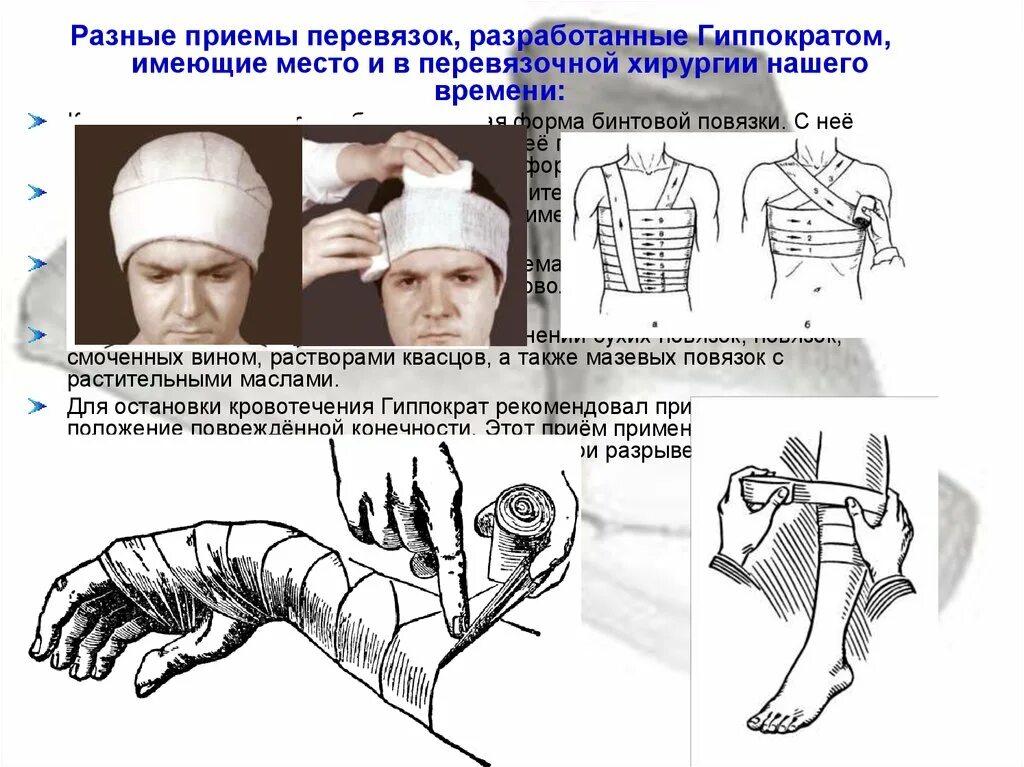 Перевязка чистой раны алгоритм. Перевязки после операции алгоритм. Алгоритм инструментальной перевязки гнойной раны. Повязки хирургия.