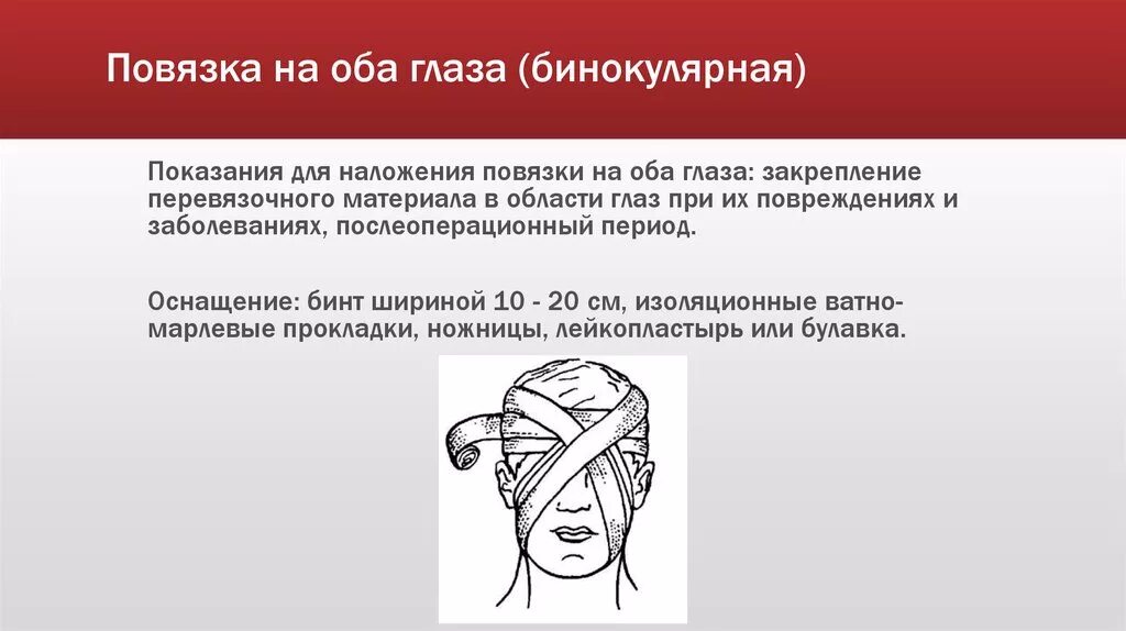 Бинокулярная повязка на оба глаза. Монокулярная повязка алгоритм. Наложение монокулярной повязки на глаз. Наложения повязки на оба глаза бинокулярная. Бинокулярная повязка на оба глаза.