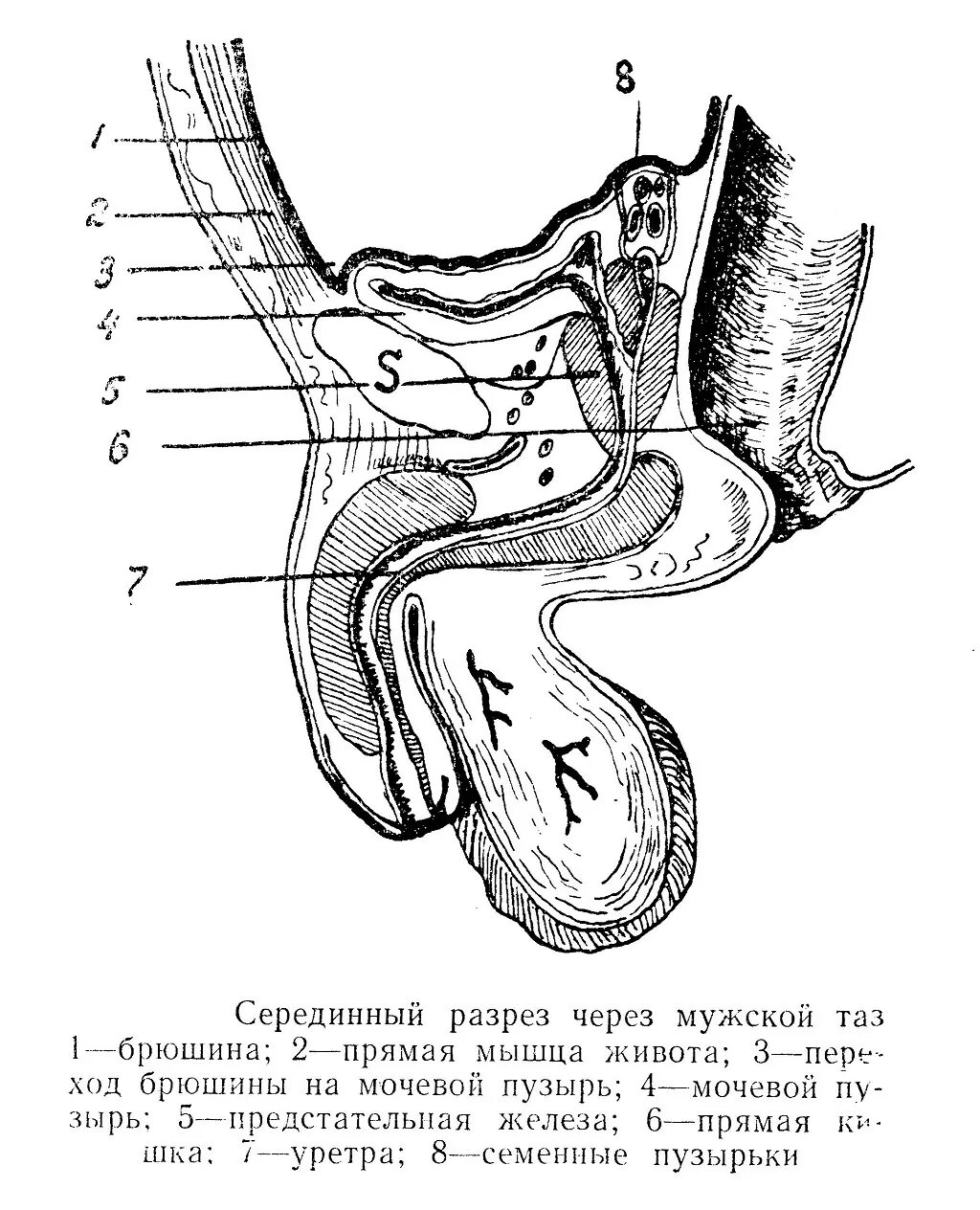 Сагиттальный разрез таза мужчины анатомия. Сагиттальный разрез малого таза мужчины. Проток семенного пузырька анатомия. Сагиттальный срез таза схема.