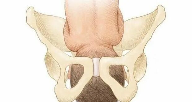 Гимнастика при симфизите при беременности. Нерасхождение иазрвых костей. Симфизит 1 степени при беременности. Расхождение костей малого таза при беременности. Расхождение костей лобкового симфиза при беременности.