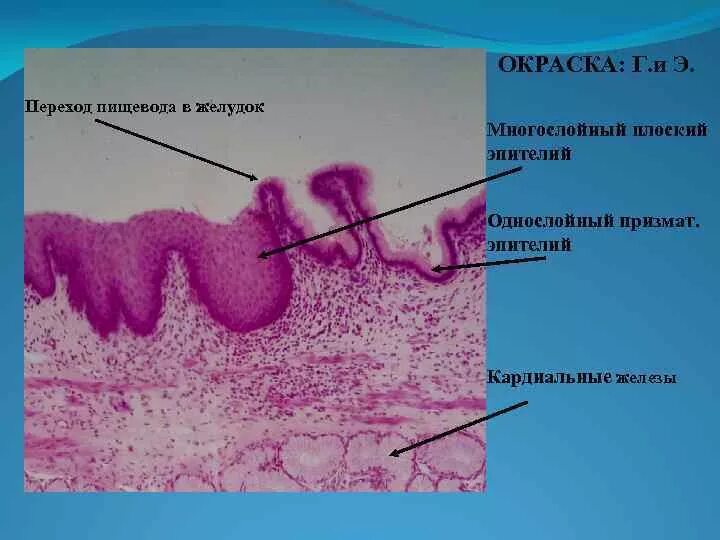 Какие железы в пищеводе. Железистый эпителий желудка гистология. Многослойный плоский неороговевающий эпителий пищевода препарат. В желудке эпителий многослойный плоский. Многослойный плоский неороговевающий эпителий пищевода гистология.