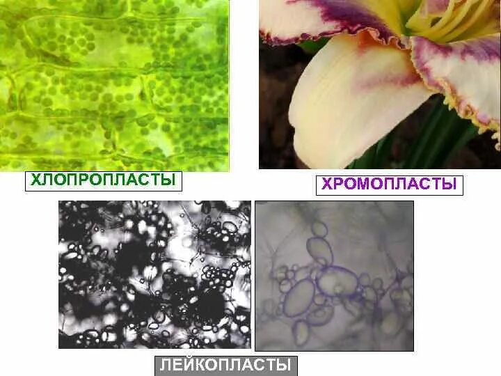 Клетка мякоти рябины. Хромопласты в клетках плодов. Хромопласты в клетках мякоти рябины. Хромопласты томата микроскопом. Лейкопласты и хромопласты.