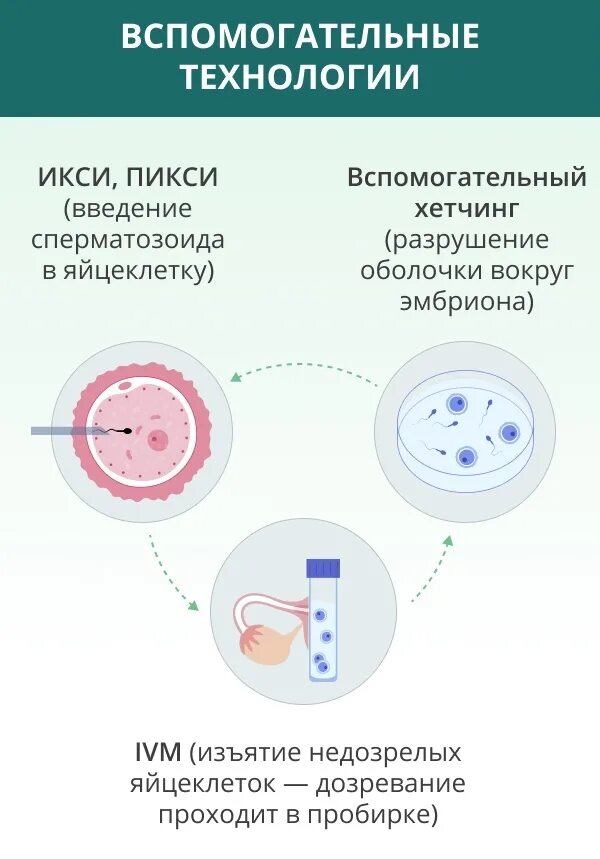 Этапы эко. Эко оплодотворение. Как делают эко сам процесс. Этапы оплодотворения. Этапы эко по дням