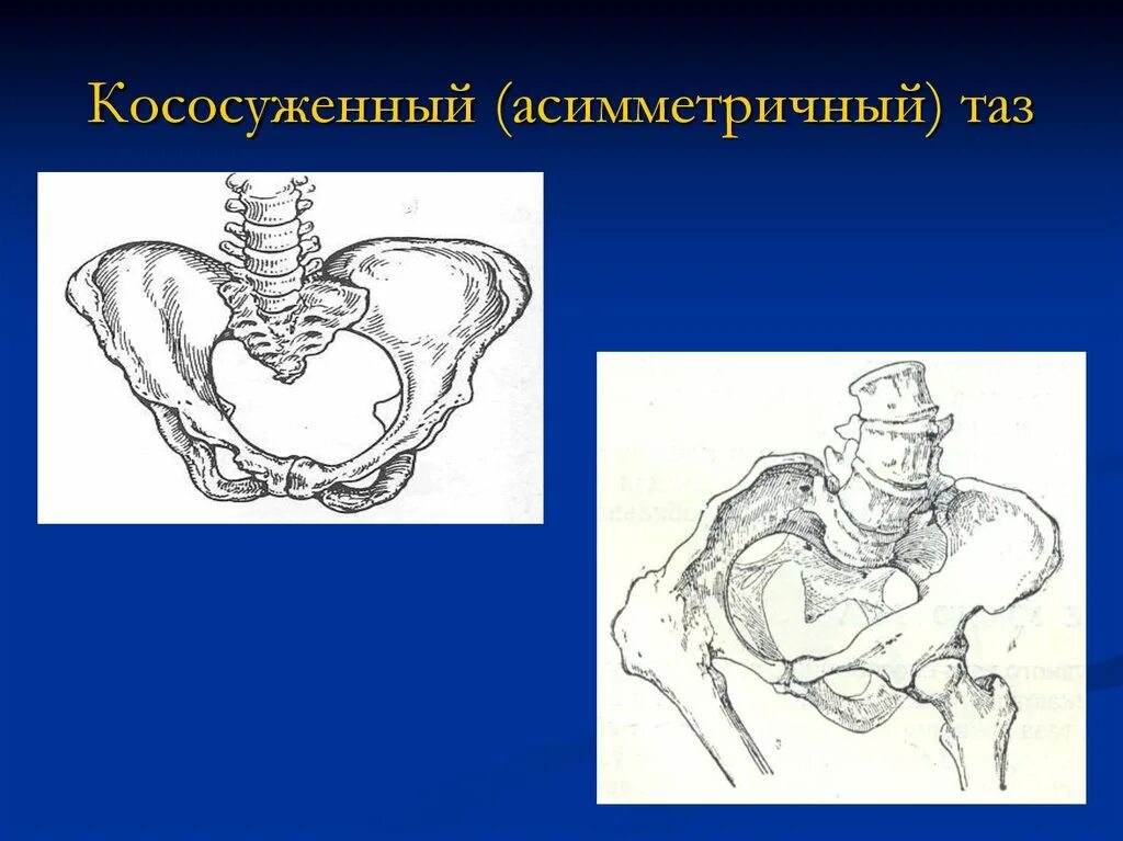 Милих пластик. Таз овальный 40 лт (уп. Таз 23 25 28 18. Наружная пельвиометрия алгоритм. 20) шт.