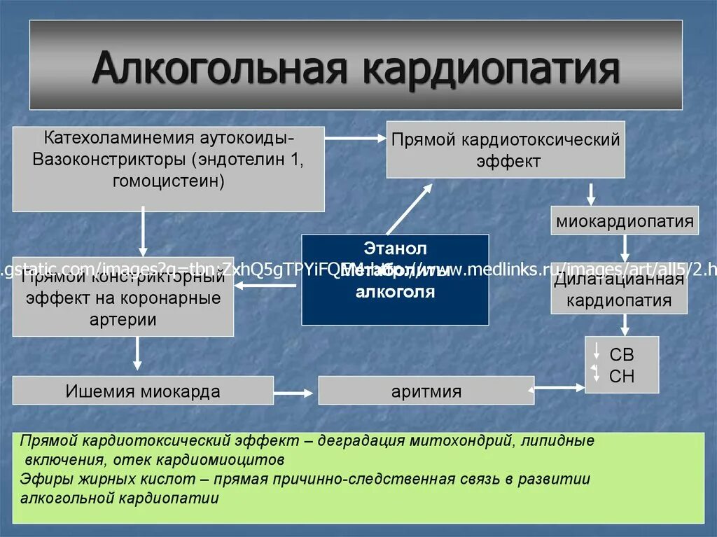 Алкогольная дилатационная кардиомиопатия. Алкогольная кардиомиопатия. Кардиопатия алкогольная. Симптомы алкогольной кардиомиопатии. Кардиопатия сердца алкогольная у взрослых.