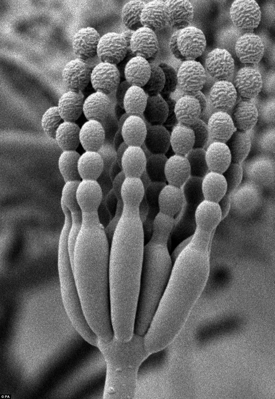 Пеницилл под микроскопом. Пеницилл микрофотография. гриб пеницилл. penicillium chrysogenum. плесень пеницилл микроскоп.