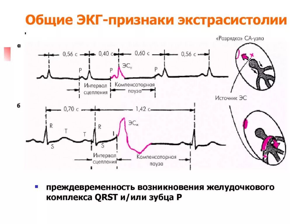 Систола при физических нагрузках