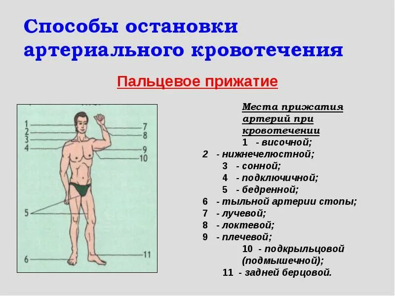 Способы остановки кровотечения пальцевое прижатие артерии. Методы остановки артериального кровотечения. Способы остановкиартериальное кровотечения. Способостоновки артериального кровотечения. Метод пальцевого прижатия артерий.