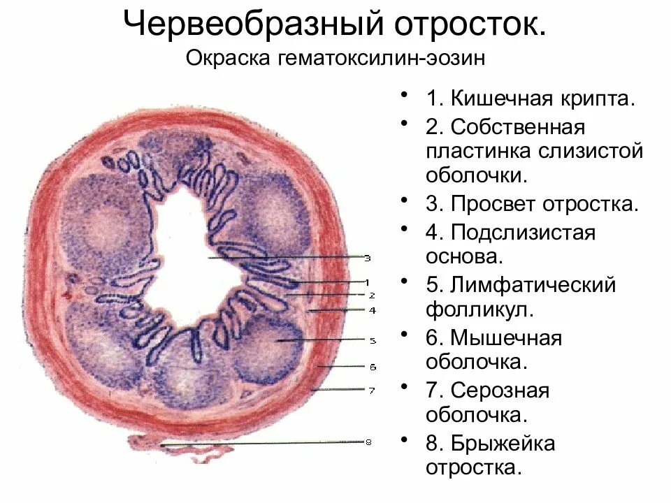 Развитие аппендикса. Строение червеобразного отростка гистология. Червеобразный отросток гистология препарат. Строение стенки червеобразного отростка. Червеобразный отросток гистология препарат описание.