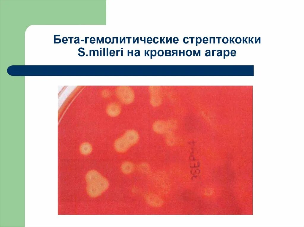 Стрептококк пиогенес на кровяном агаре. Бета гемолиз на кровяном агаре стрептококк. Стрептококкус агаре стрептококк на кровяном. В-гемолитические стрептококки на кровяном агаре. Тест стрептококк группы а