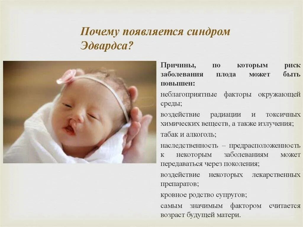Почему синдром. Синдром эдвардса фенотипические проявления. характерные признаки синдрома эдвардса. синдром эдвардса факторы риска. синдром эдвардса клинические проявления.