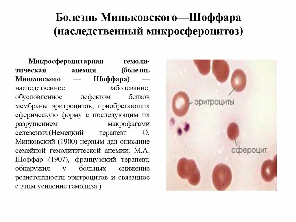 Место разрушения клеток крови. Болезнь Минковского Шоффара. Наследственный микросфероцитоз (болезнь Минковского-Шоффара). Анемия Минковского-Шоффара патогенез. Наследственный сфероцитоз картина крови.