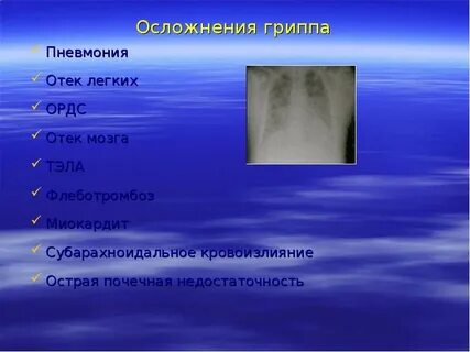 Отек легких осложнения