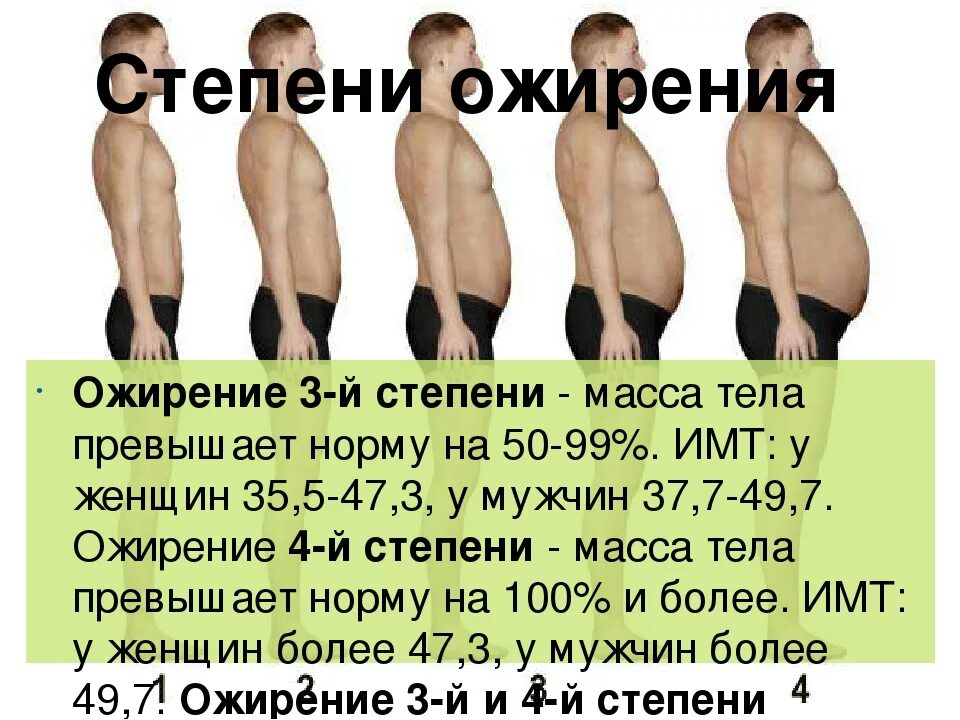 2 стадия ожирения