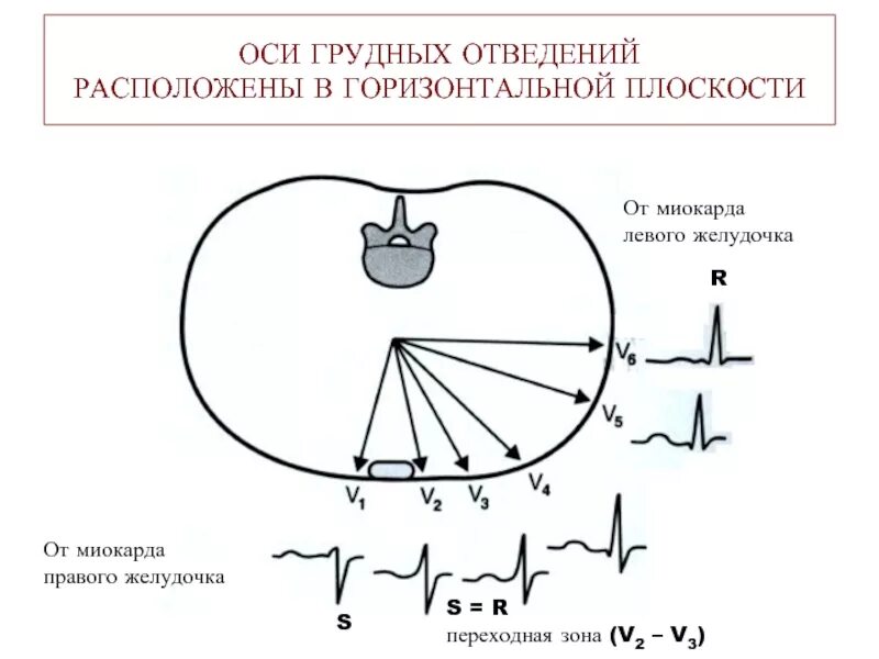 Оси сердца грудные отведения. В горизонтальной плоскости расположены оси отведений:. Расположение осей 6 грудных отведений в горизонтальной плоскости. Отведения грудные отведения. Правые грудные отведения