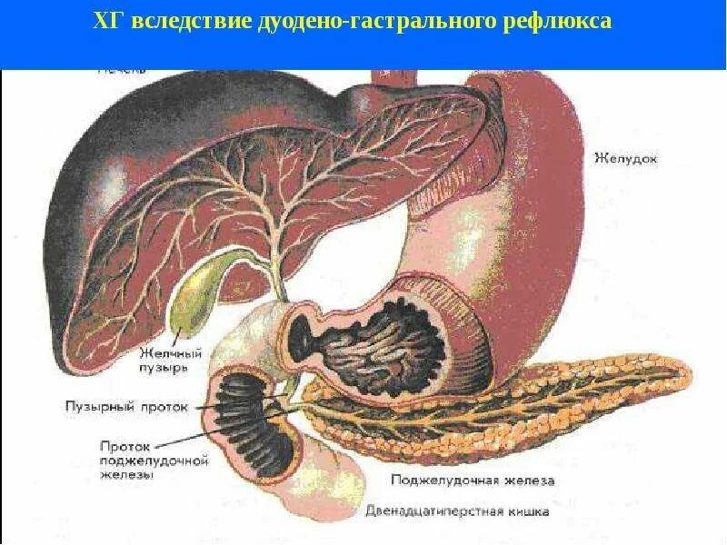 Соединение протоком с поджелудочной железой желудок
