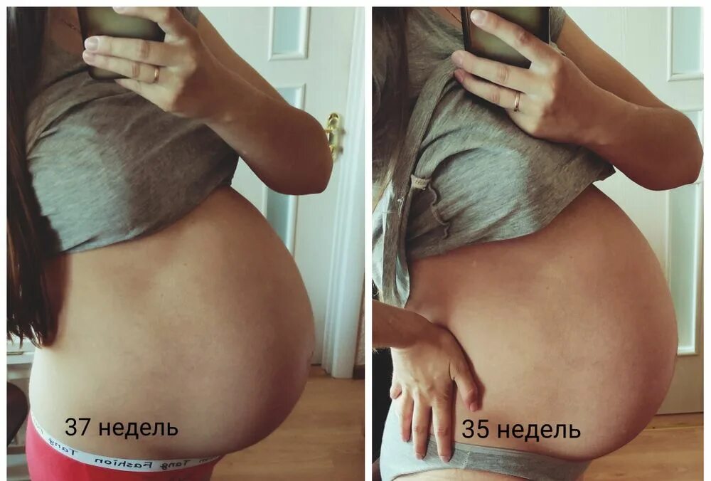 Должен ли опускаться живот. Должен ли опускаться живот
