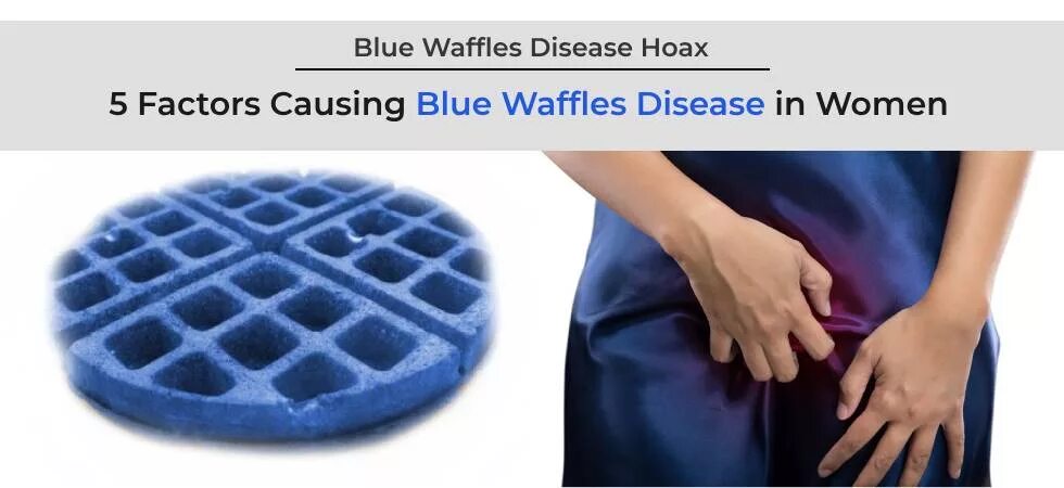 Синие вафли. Blue waffles женская болезнь. Вафля болезнь. Вафля болезнь. Вафля болезнь.