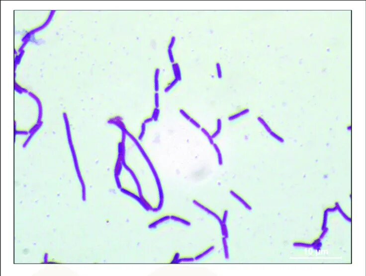 Лептотрикс лечение. Lactobacillus plantarum 8p-a3 мазок. Лептотрикс микроскопия. Лактобактерии микроскопия. Молочнокислые бактерии (Lactobacillus plantarum).