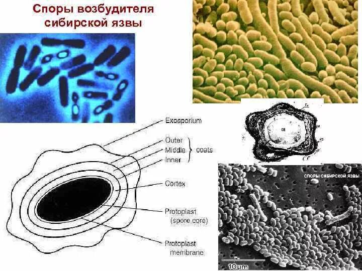 Споры сибирской язвы микробиология. Споры бацилл сибирской язвы. Сибирская язва строение бактерии. Споры сибирской язвы под микроскопом. Клетка язвы