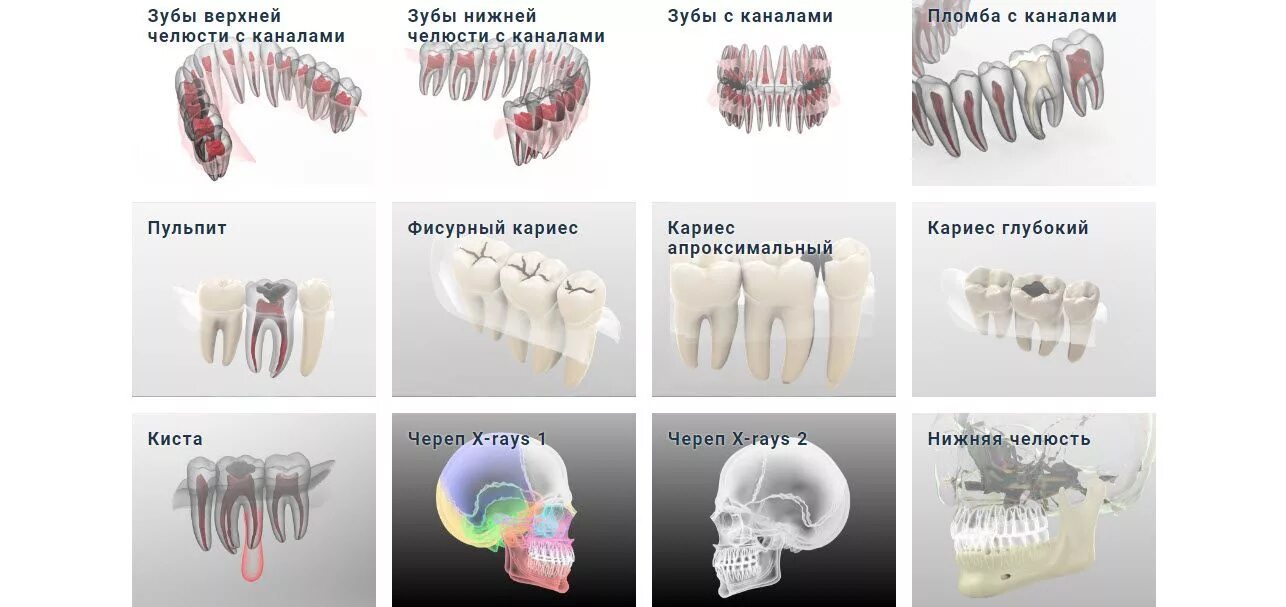 Каналы зубов верхней челюсти. Топография зуба.