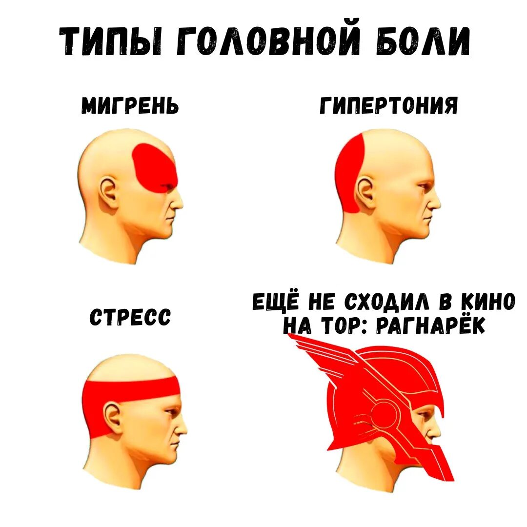 Болит голова. Типы головной боли. Голова болит Мем. Типы боли в голове.