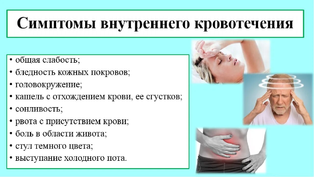 Признаки внутреннего кровотечения. Признаки внутри кровотечения. Признаками внутреннего кровотечения являются:. Характерное проявление внутреннего кровотечения.